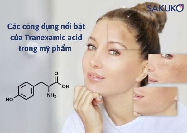 Các công dụng nổi bật của Tranexamic acid trong mỹ phẩm