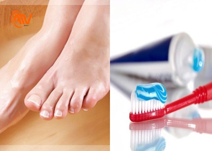 Sử dụng kem đánh răng để khử mùi hôi chân