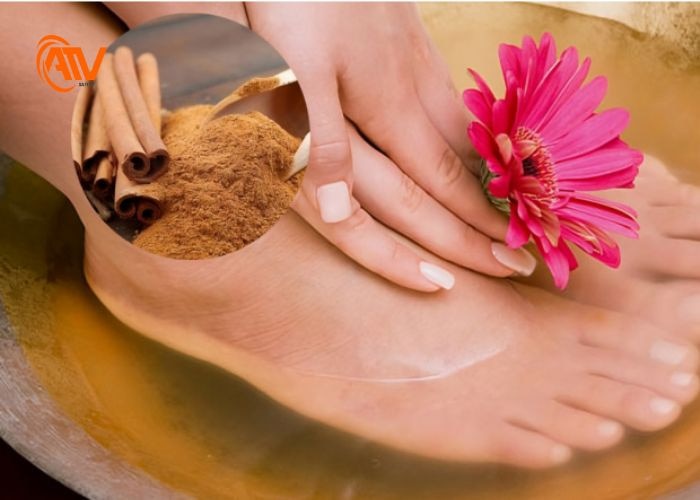 Cách khử mùi hôi chân bằng quế hiệu quả