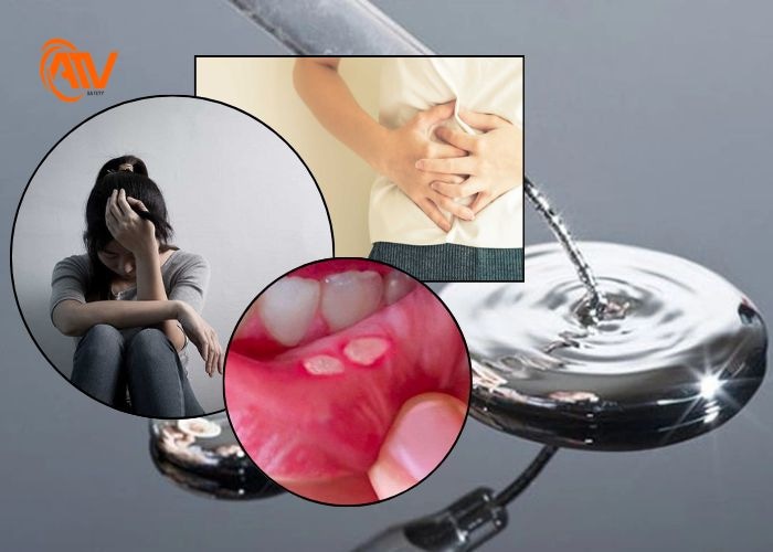 Triệu chứng của việc ngộ độc thủy ngân vô cơ