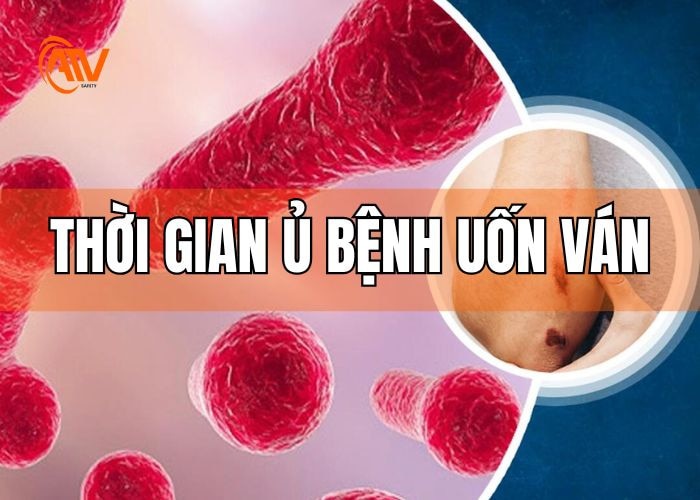 Thời gian phát bệnh uốn ván