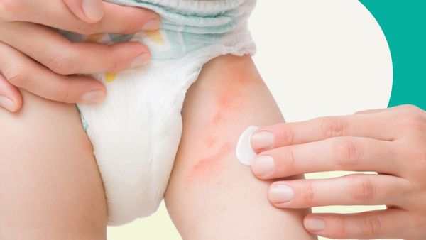 Bé khóc khi bỉm gây khó chịu