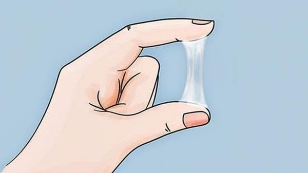 Bong nút nhầy cổ tử cung