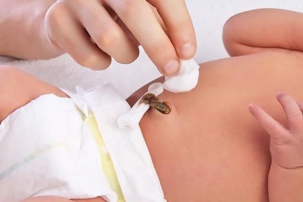 Vệ sinh rốn cho trẻ sơ sinh