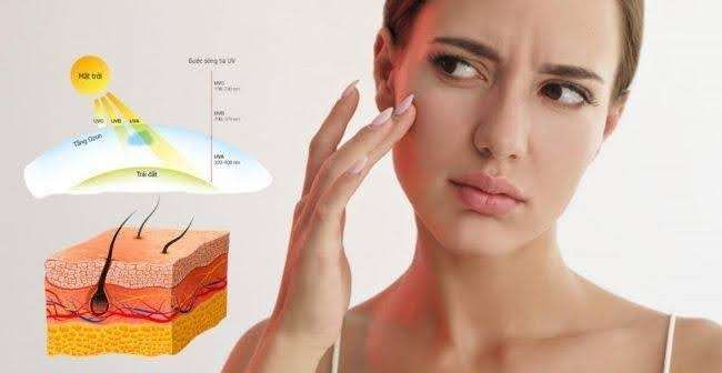 Vì sao nám không chỉ là vấn đề “ngoài da”?