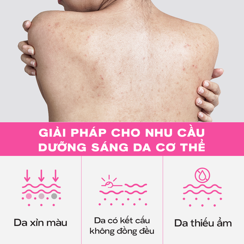 thegioiskinfood.com - Tinh Chất Dưỡng Thể Hỗ Trợ Dưỡng Sáng, Làm Đều Màu Da Skinoxy Pro Concentrate Body Serum 275g