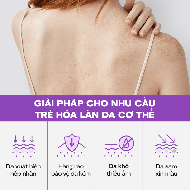 thegioiskinfood.com - Tinh Chất Dưỡng Thể Hỗ Trợ Dưỡng Sáng, Làm Đều Màu Da Skinoxy Pro Concentrate Body Serum 275g