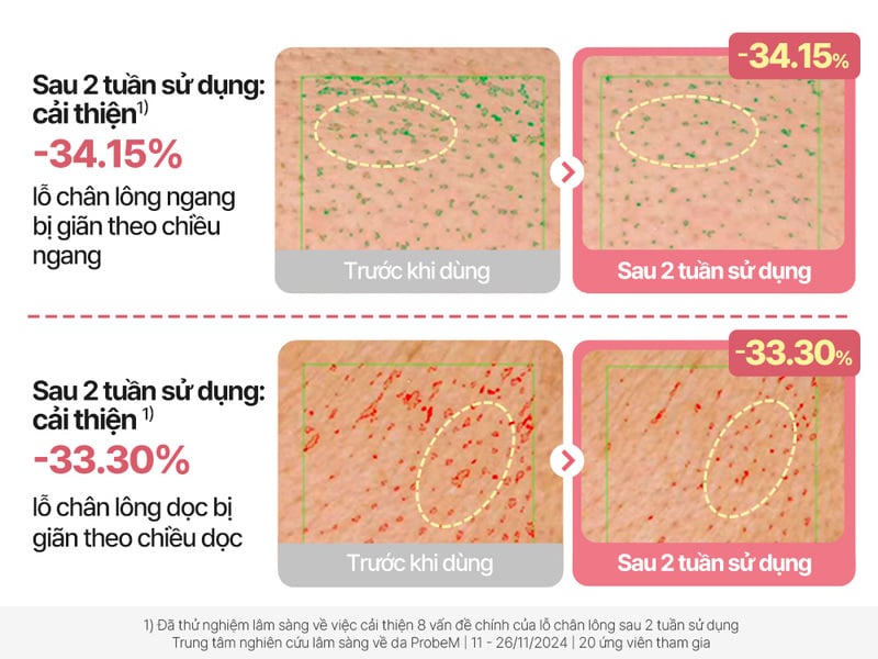 thegioiskinfood.com - Serum Torriden Chăm Sóc Lỗ Chân Lông Cellmazing Pore Perfecting Ampoule 30ml