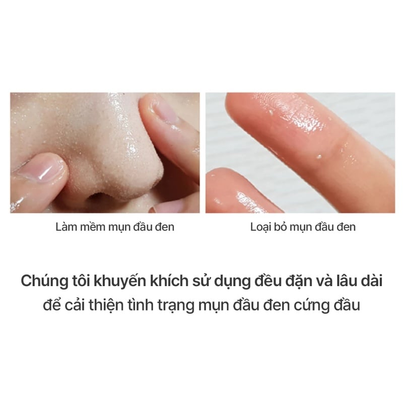 thegioiskinfood.com - Dầu Tẩy Trang Sạch Sâu, Cải Thiện Mụn Đầu Đen Celimax Derma Nature Fresh Blackhead Jojoba Cleansing Oil 150ml