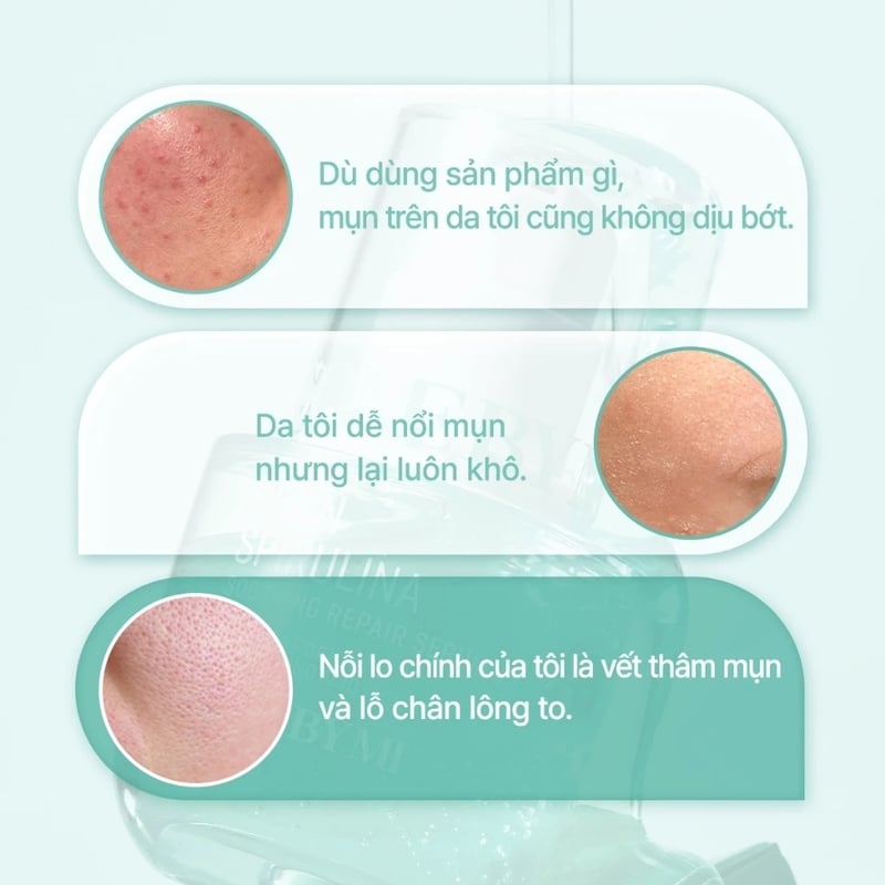 Serum Làm Dịu Da Mụn, Hỗ Trợ Phục Hồi Some By Mi PDRN Spirulina Soothing Repair Serum 50ml