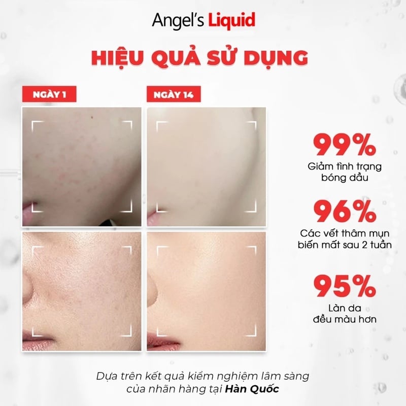 thegioiskinfood.com - Serum Hỗ Trợ Dưỡng Sáng, Kiểm Soát Dầu Angel's Liquid Glutathione Plus Niacinamide Cica Ampoule 45ml