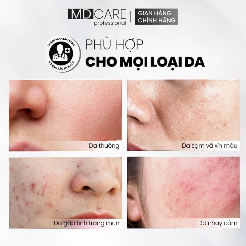 Tẩy Tế Bào Chết Hỗ Trợ Làm Sáng, Mờ Thâm Và Đều Màu Da MD CARE Professional Glow Exfo For Rough Bumpy Skin 30ml