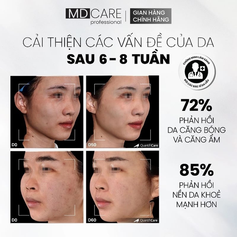 Tẩy Tế Bào Chết Căng Bóng, Cấp Ẩm Và Làm Sáng Da MD CARE Professional Mande Exfo-For All Skin Types