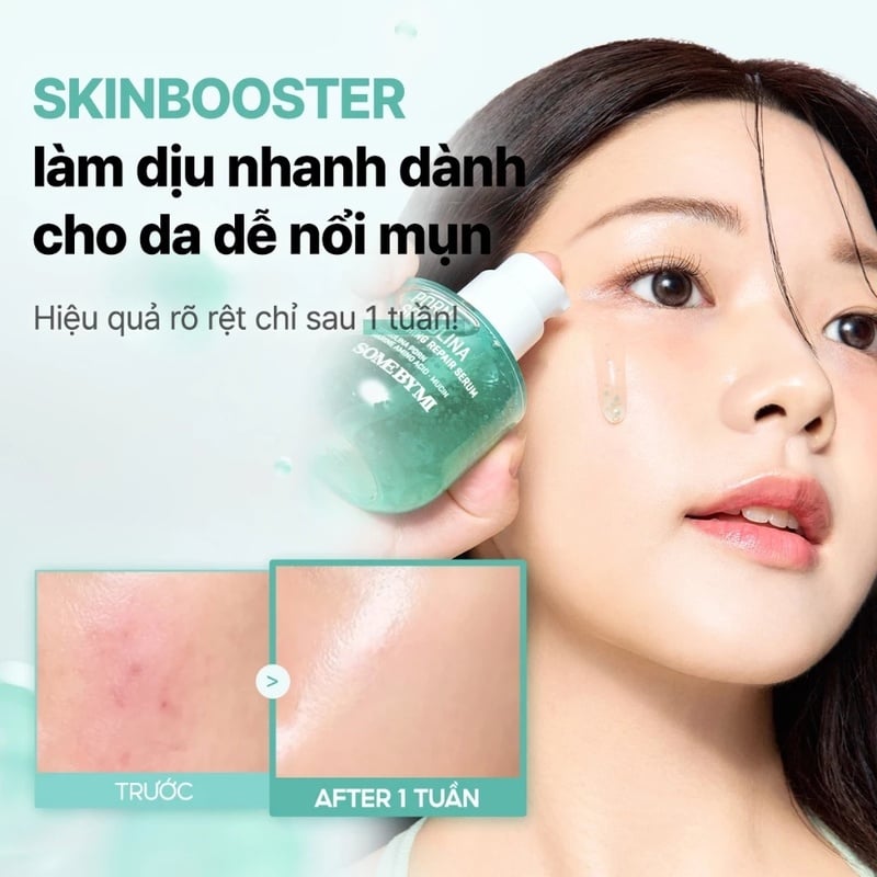 Serum Làm Dịu Da Mụn, Hỗ Trợ Phục Hồi Some By Mi PDRN Spirulina Soothing Repair Serum 50ml