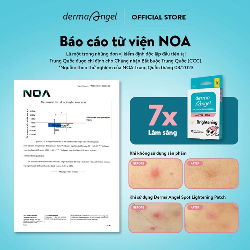 thegioiskinfood.com - Miếng Dán Mụn Mờ Thâm Sáng Da Derma Angel Spot Lightening Patch With TXA + CICA Brightening (12 miếng)