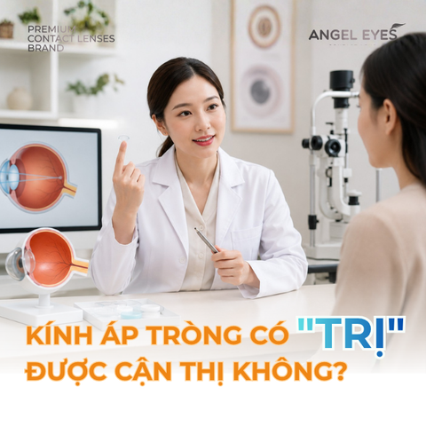 Kính Áp Tròng Có