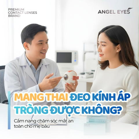 Mang thai đeo kính áp tròng được không?
