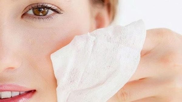 dị ứng khăn ướt