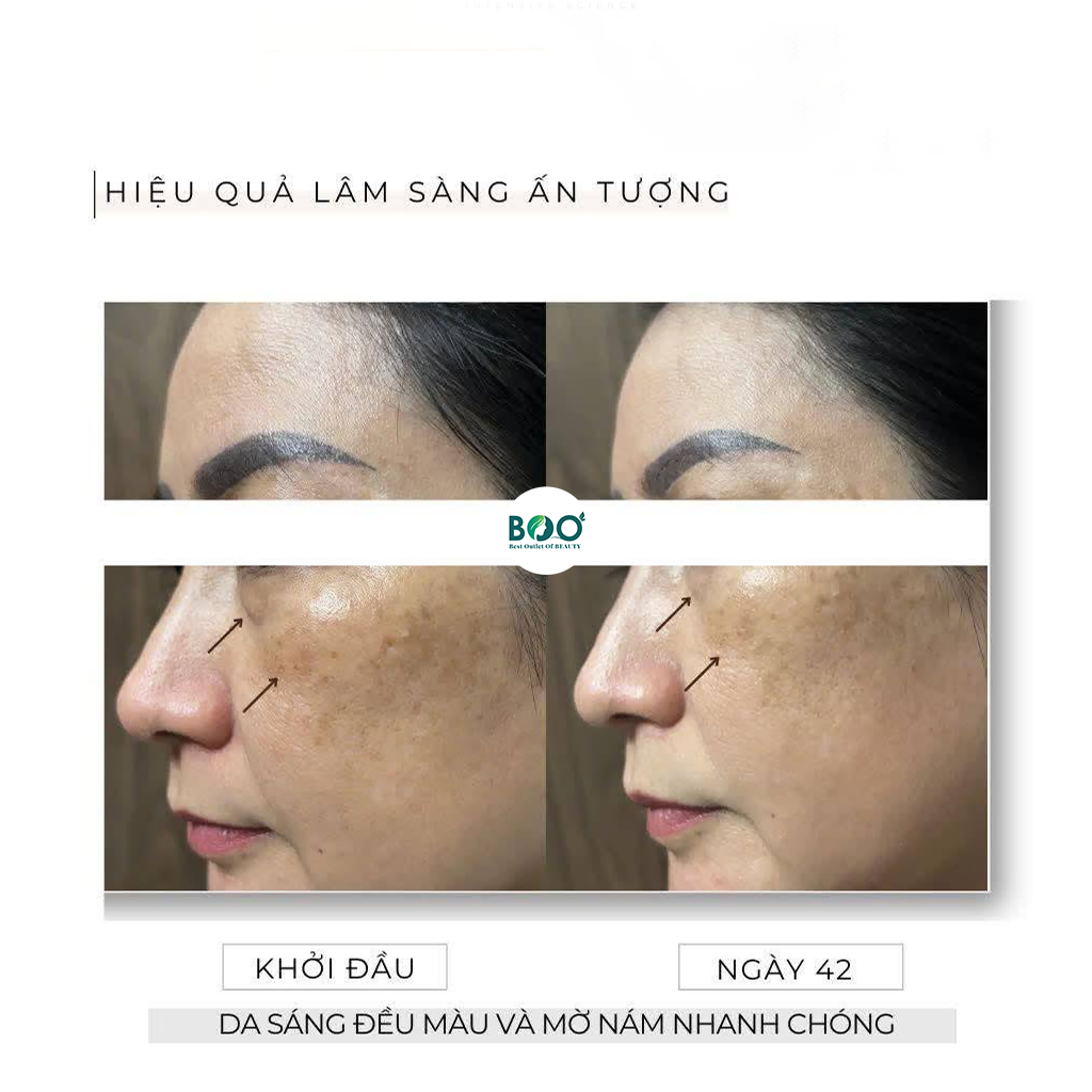Đối tượng sử dụng lý tưởng của OROBANC Beta-Tranex Brightening Cream