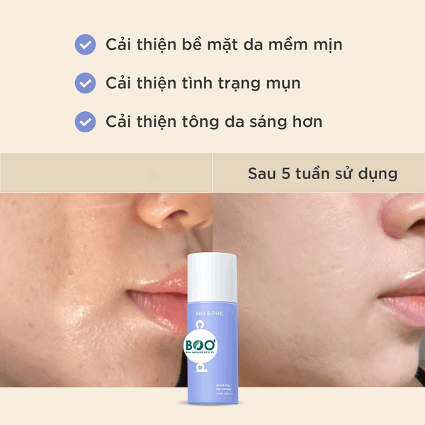 Tổng quan Gel AHA PHA tẩy da chết Candid làm mềm mịn da