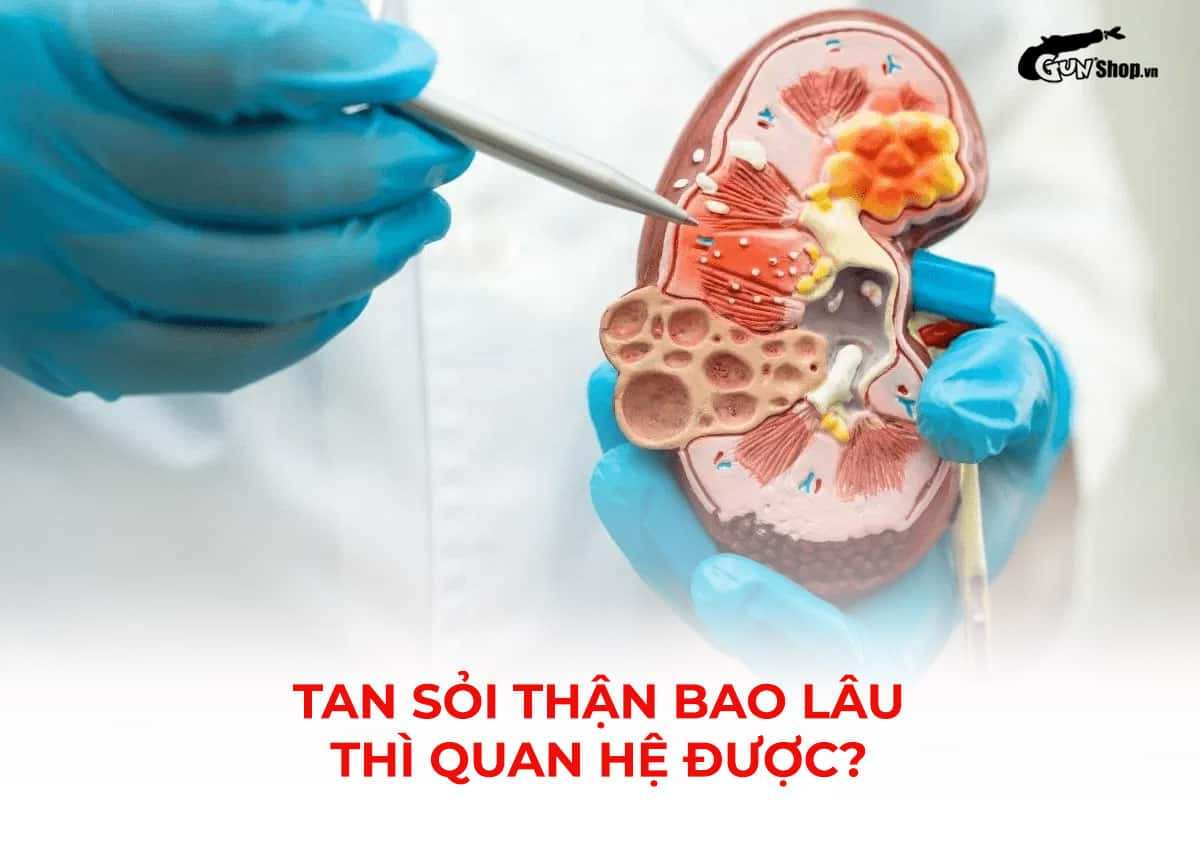 Tan sỏi thận bao lâu thì quan hệ được?