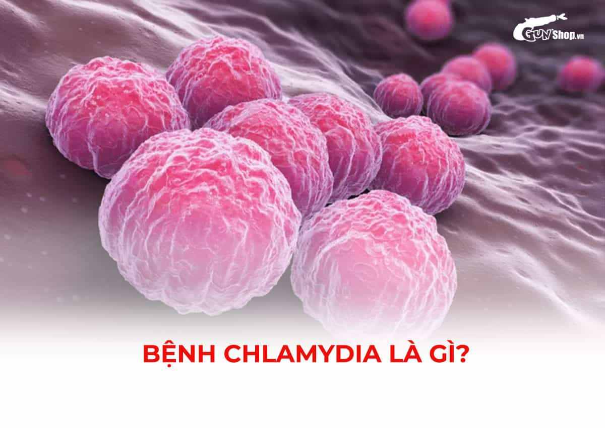 Bệnh Chlamydia là gì?