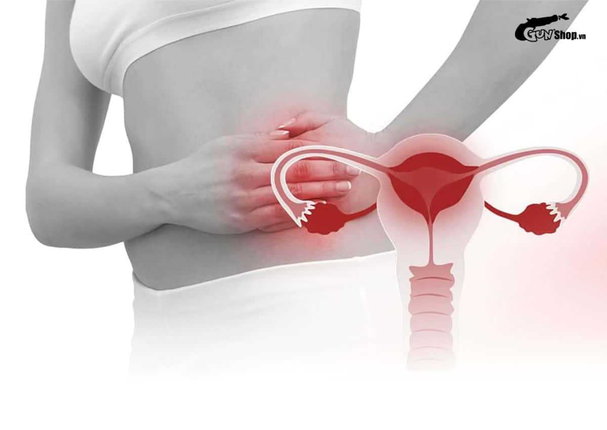Bệnh Chlamydia là gì?