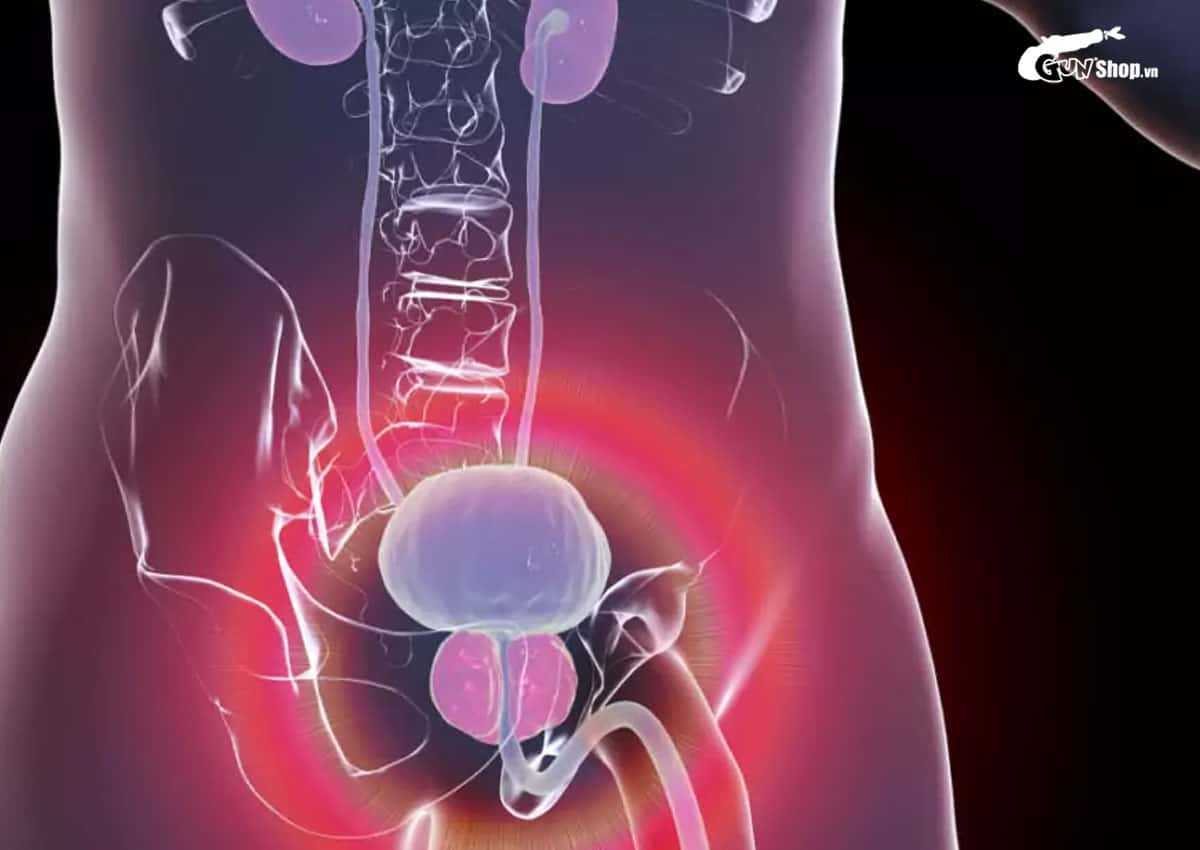 Nguyên nhân chồng không xuất được tinh