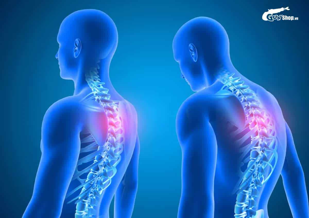 Bị bệnh gai cột sống có quan hệ được không?