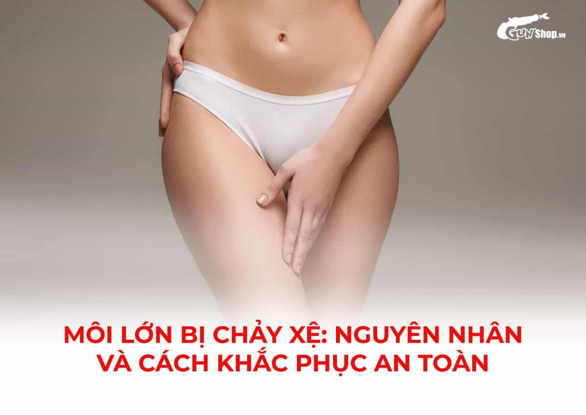 Nguyên nhân và cách khắc phục tình trạng môi lớn chảy xệ