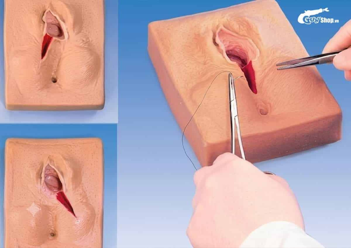 Nguyên nhân và cách khắc phục tình trạng môi lớn chảy xệ