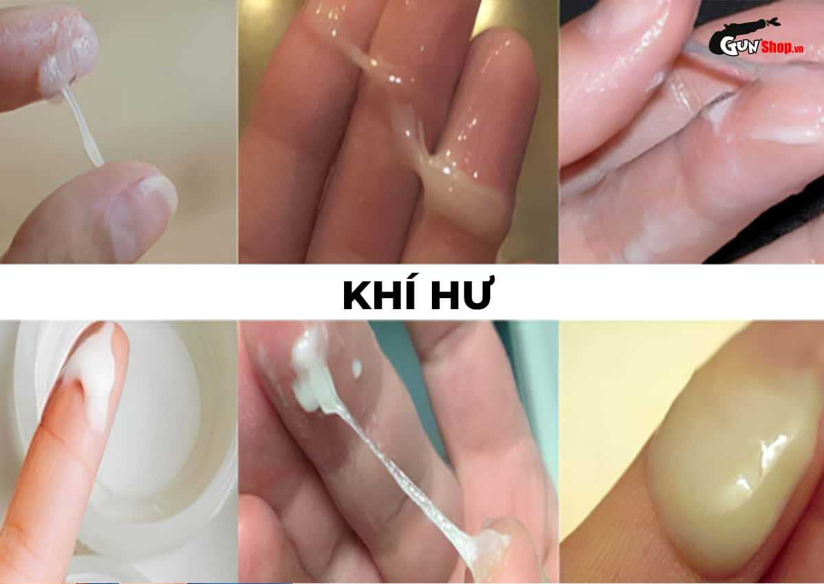 Nhiễm khuẩn đường sinh dục là gì?