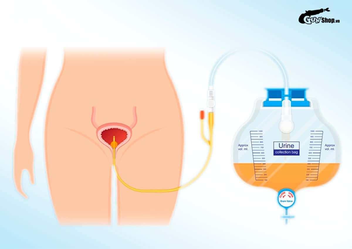 Lỗ niệu đạo nữ để làm gì