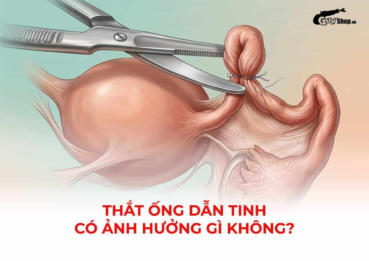 Thắt ống dẫn tinh có ảnh hưởng gì không?