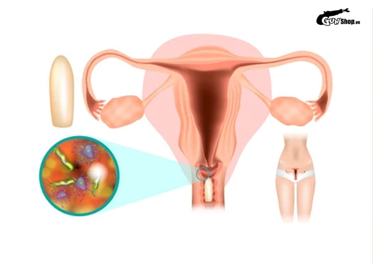 Xuất tinh trong âm đạo gây ra những rủi ro và nguy cơ gì?