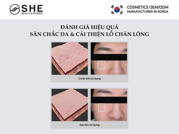 Xịt khoáng Peptide