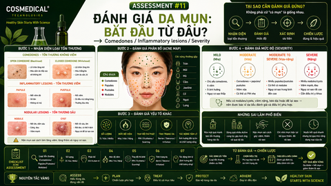 ASSESSMENT #11 — Đánh giá da mụn: bắt đầu từ đâu?