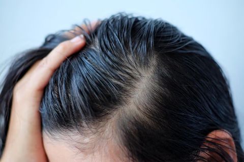 Cách giúp tóc mọc dày trở lại và trông dày hơn tự nhiên