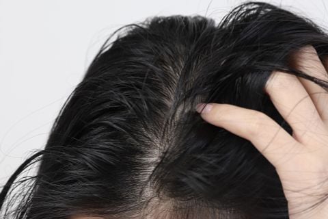 Dầu gội cho da đầu dầu: Cách giảm bết mà không làm khô tóc