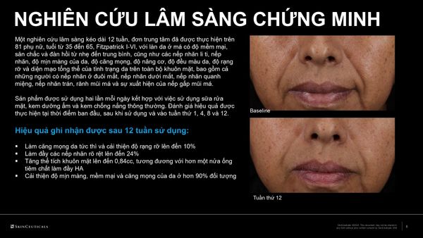So Sánh SkinCeuticals HA Intensifier Multi Glycan Mới Và Bản Cũ: Có Đáng Để Nâng Cấp?