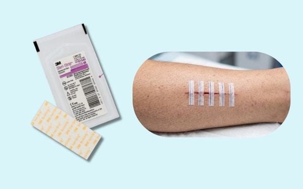 Băng dán thay chỉ khâu Steri-Strip