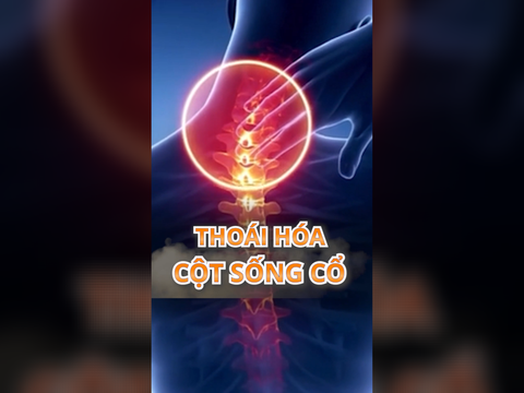 THOÁI HOÁ CỘT SỐNG CỔ