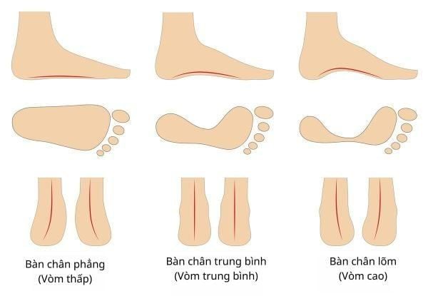 Chọn giày phù hợp cho người chạy bộ