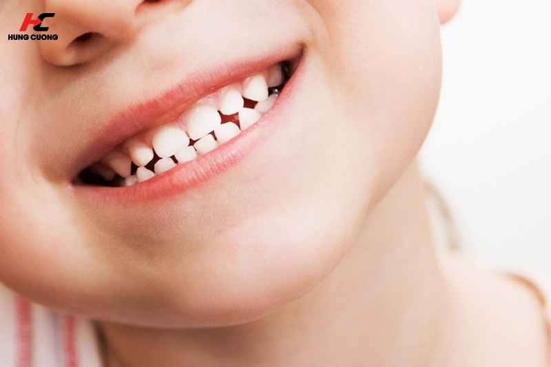 Vệ sinh răng miệng sau khi cho trẻ uống Sắt