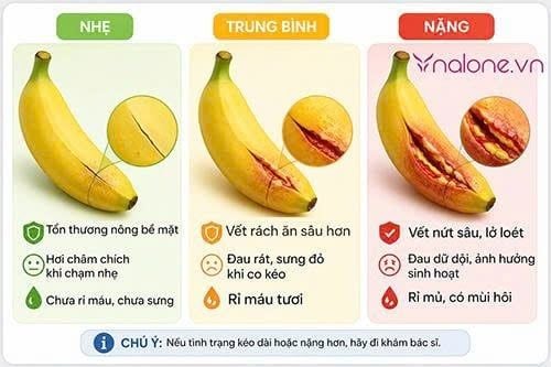 Nứt bao quy đầu là gì?