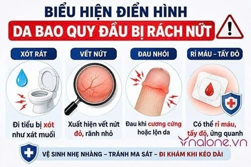 Nứt bao quy đầu là gì?