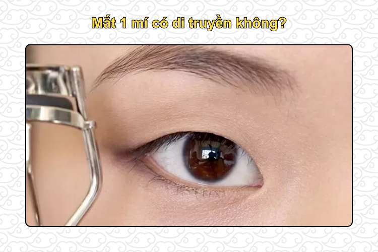 mắt 1 mí có di truyền không