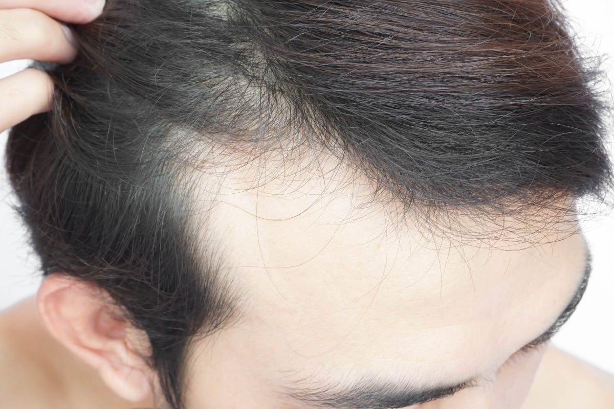 thoi-quen-xau-gay-hoi-dau-phan-an-asia