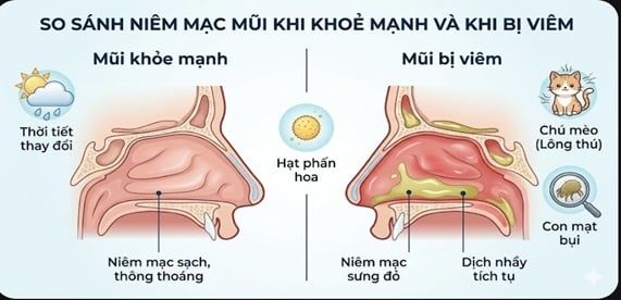 Viêm mũi dị ứng: Đừng để