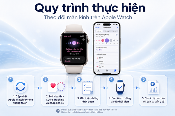 Quy trình thực hiện